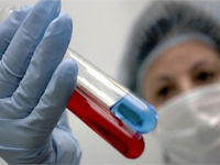 В Украине хотят ввести обязательны тест на ВИЧ при приеме на работу